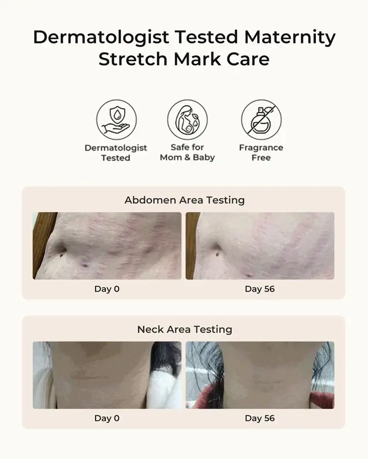 Momcozy Pro-Collagen Belly Firming Moisturizer *150g - Figura 9